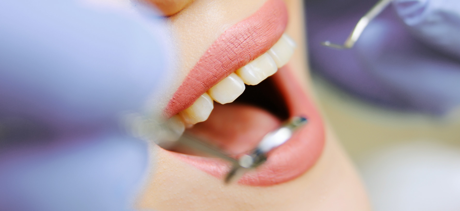 Zahnarzt Dr. Marco Eck - Parodontitis 1